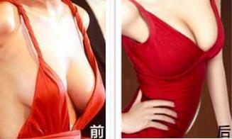 <a href=http://www.sbs17.com/listinfo-623-0.html target=_blank class=infotextkey>乳房下垂矯正</a>手術(shù)適合人群