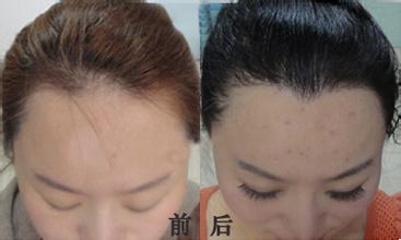 <a href=http://www.sbs17.com/listinfo-669-0.html target=_blank class=infotextkey>美人尖種植</a>價格