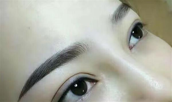 做眉毛整形術(shù)后如何護理