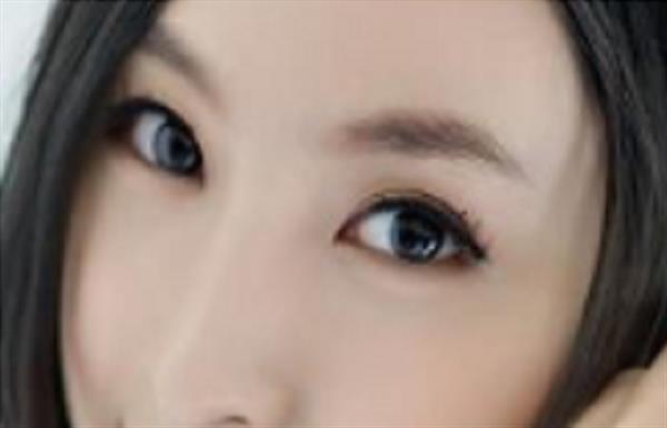 做<a href=http://www.sbs17.com/listinfo-650-0.html target=_blank class=infotextkey>眉部整形</a>術(shù)后如何注意護(hù)理
