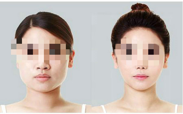 打<a href=http://www.sbs17.com/listinfo-734-0.html target=_blank class=infotextkey>愛貝芙</a>有什么危害？