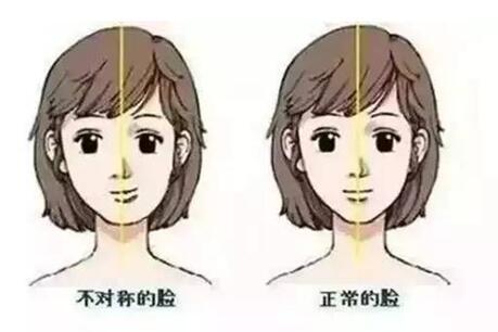 大小臉嚴(yán)重怎么調(diào)整