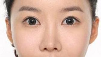 在廣州做<a href=http://www.sbs17.com/listinfo-704-0.html target=_blank class=infotextkey>眼部整形</a>手術(shù)多少錢