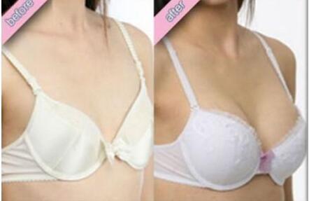 注射<a href=http://www.sbs17.com/listinfo-618-0.html target=_blank class=infotextkey>隆胸</a>安全嗎
