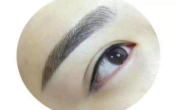 提眉術(shù)的缺點