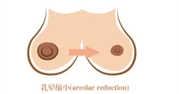 還在擔(dān)心乳暈問題嗎？粉嫩少女性就是現(xiàn)在！