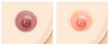 乳頭<a href=http://www.sbs17.com/listinfo-625-0.html target=_blank class=infotextkey>乳暈縮小</a>多少錢(qián)？