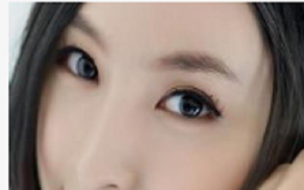 提眉術(shù)后多久可以恢復(fù)自然？