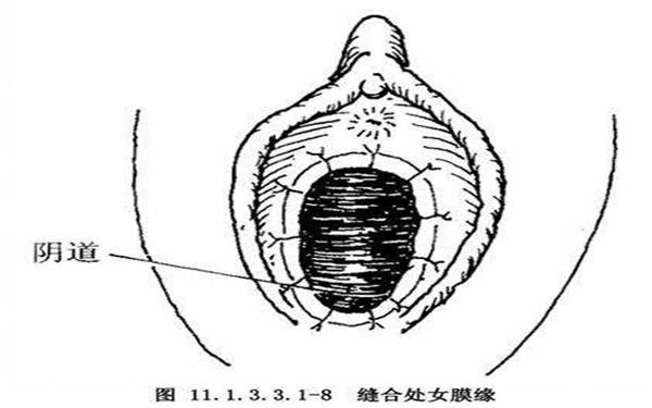 <a href=http://www.sbs17.com/listinfo-805-0.html target=_blank class=infotextkey>處女膜修復(fù)</a>的三種方法