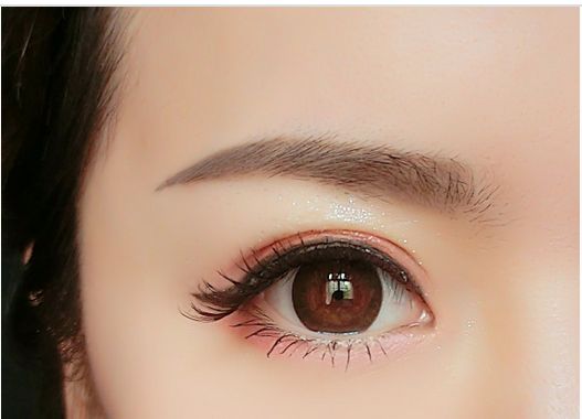 <a href=http://www.sbs17.com/listinfo-655-0.html target=_blank class=infotextkey>切眉</a>手術(shù)后的圖片