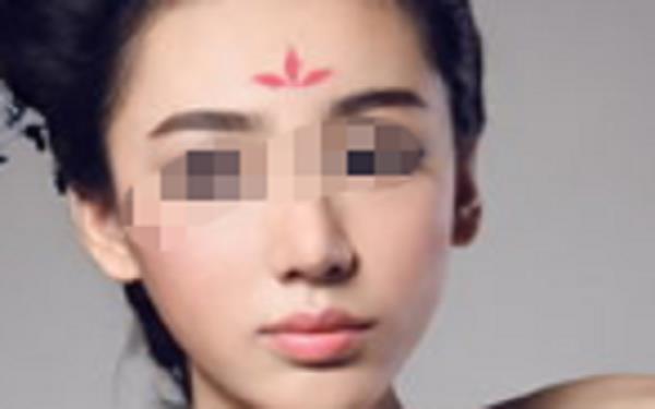 提眉術(shù)會(huì)有哪些風(fēng)險(xiǎn)呢？