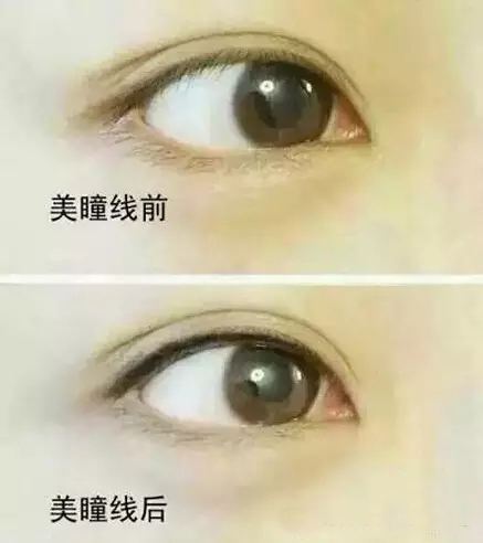 紋<a href=http://www.sbs17.com/listinfo-705-0.html target=_blank class=infotextkey>美瞳線</a>幾天能恢復(fù)