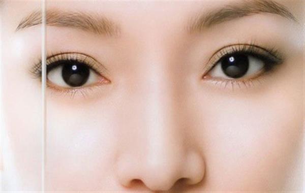 <a href=http://www.sbs17.com/listinfo-724-0.html target=_blank class=infotextkey>雙眼皮</a>整形要多少錢