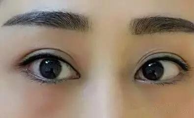 紋過<a href=http://www.sbs17.com/listinfo-705-0.html target=_blank class=infotextkey>美瞳線</a>后注意事項(xiàng)