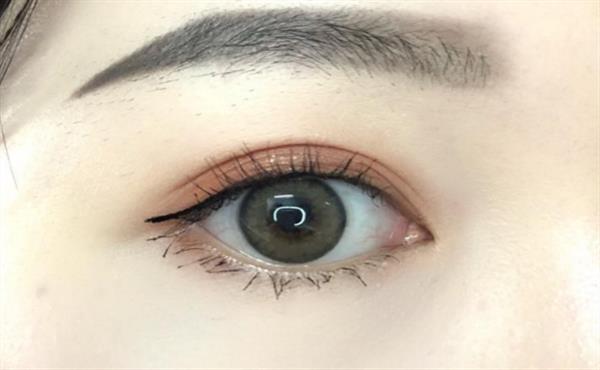 多眼皮怎么變回<a href=http://www.sbs17.com/listinfo-724-0.html target=_blank class=infotextkey>雙眼皮</a>的方法有哪些