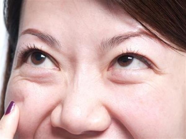 熱熔<a href=http://www.sbs17.com/listinfo-708-0.html target=_blank class=infotextkey>去眼袋</a>疼嗎