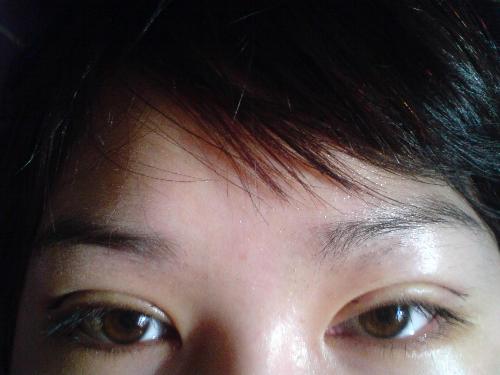 割<a href=http://www.sbs17.com/listinfo-724-0.html target=_blank class=infotextkey>雙眼皮</a>多久自然