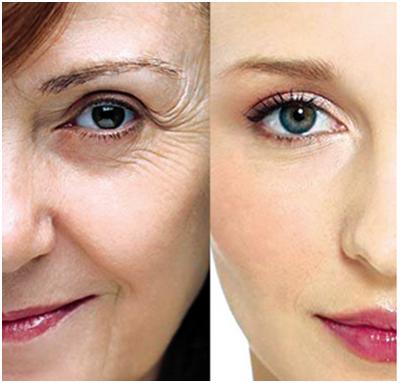 注射botox<a href=http://www.sbs17.com/listinfo-614-0.html target=_blank class=infotextkey>除皺</a>瘦型素<a href=http://www.sbs17.com/listinfo-614-0.html target=_blank class=infotextkey>除皺</a>瘦型素<a href=http://www.sbs17.com/listinfo-614-0.html target=_blank class=infotextkey>除皺</a>安全嗎