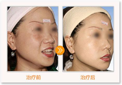 水光<a href=http://www.sbs17.com/listinfo-770-0.html target=_blank class=infotextkey>嫩膚</a>原理
