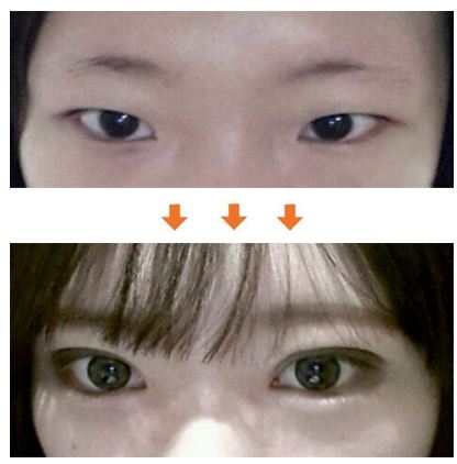 割<a href=http://www.sbs17.com/listinfo-724-0.html target=_blank class=infotextkey>雙眼皮</a>會痛嗎