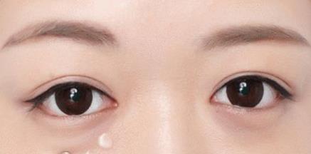 抽脂<a href=http://www.sbs17.com/listinfo-708-0.html target=_blank class=infotextkey>去眼袋</a>多少錢(qián)