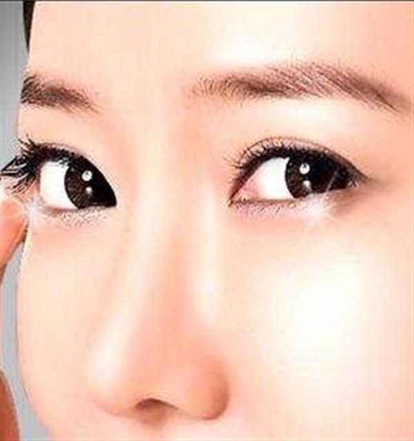 摩皺<a href=http://www.sbs17.com/listinfo-708-0.html target=_blank class=infotextkey>去眼袋</a>效果好嗎