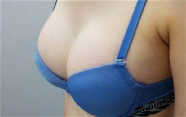 女性豐胸用什么好