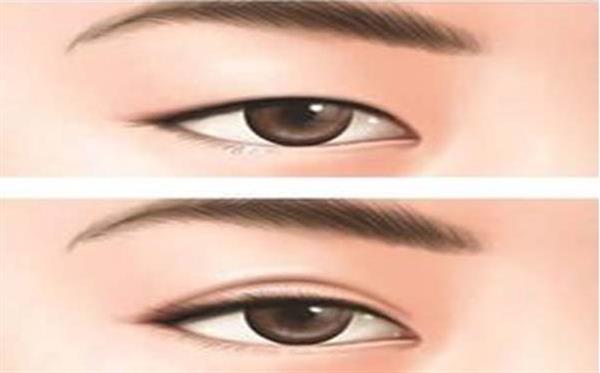 埋線<a href=http://www.sbs17.com/listinfo-724-0.html target=_blank class=infotextkey>雙眼皮</a>多少