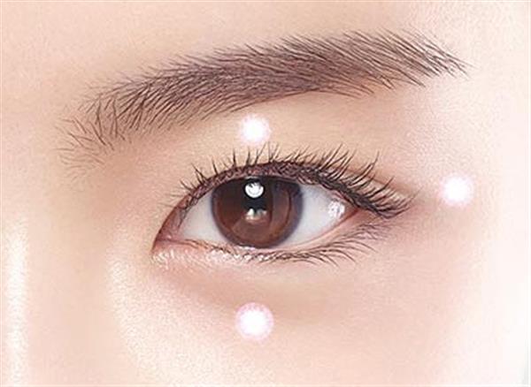 三點(diǎn)<a href=http://www.sbs17.com/listinfo-724-0.html target=_blank class=infotextkey>雙眼皮</a>手術(shù)效果及適應(yīng)人群