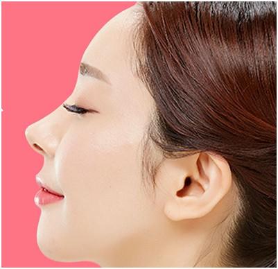 假體<a href=http://www.sbs17.com/listinfo-737-0.html target=_blank class=infotextkey>隆鼻</a>多久能恢復(fù)好