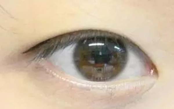 <a href=http://www.sbs17.com/listinfo-711-0.html target=_blank class=infotextkey>開(kāi)眼角</a>拆線疼嗎