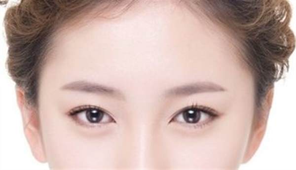 脂肪填充太陽(yáng)穴好嗎