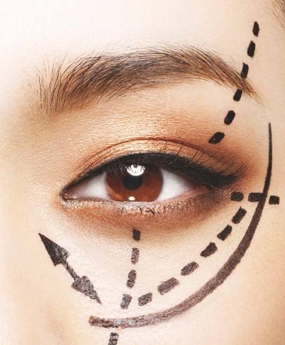 割<a href=http://www.sbs17.com/listinfo-724-0.html target=_blank class=infotextkey>雙眼皮</a>會引起臉腫嗎