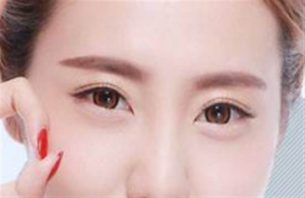 怎么分辨<a href=http://www.sbs17.com/listinfo-724-0.html target=_blank class=infotextkey>雙眼皮</a>