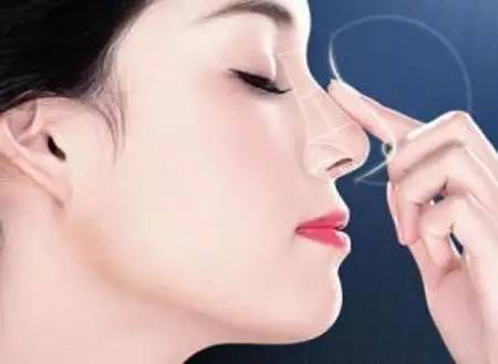 什么牌子硅膠<a href=http://www.sbs17.com/listinfo-737-0.html target=_blank class=infotextkey>隆鼻</a>好