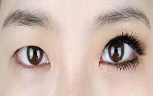 <a href=http://www.sbs17.com/listinfo-724-0.html target=_blank class=infotextkey>雙眼皮</a>拆線到底疼不疼