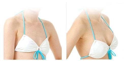 假體<a href=http://www.sbs17.com/listinfo-618-0.html target=_blank class=infotextkey>隆胸</a>后可以哺乳嗎