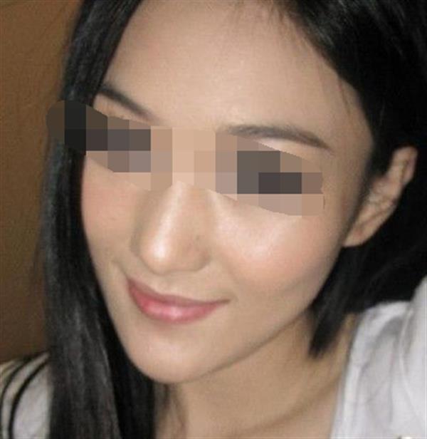 <a href=http://www.sbs17.com/listinfo-631-0.html target=_blank class=infotextkey>瘦臉</a>整形的方法有哪些