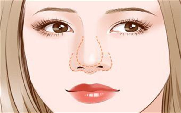 硅膠<a href=http://www.sbs17.com/listinfo-737-0.html target=_blank class=infotextkey>隆鼻</a>手術(shù)能維持多久