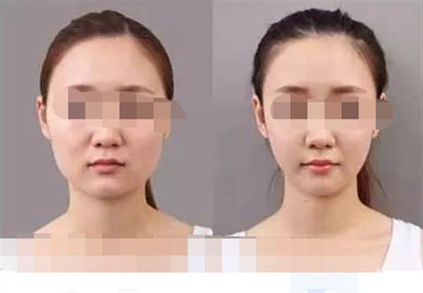 學(xué)生有效的<a href=http://www.sbs17.com/listinfo-631-0.html target=_blank class=infotextkey>瘦臉</a>方法
