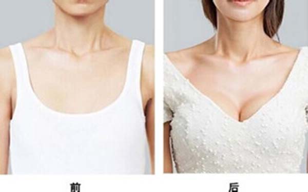 硅膠假體<a href=http://www.sbs17.com/listinfo-618-0.html target=_blank class=infotextkey>隆胸</a>對哺乳有影響嗎