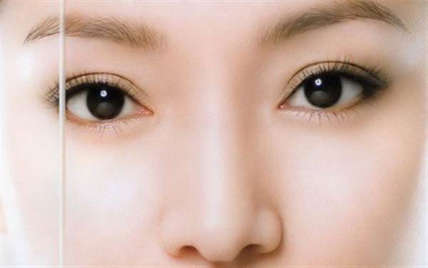 <a href=http://www.sbs17.com/listinfo-724-0.html target=_blank class=infotextkey>雙眼皮</a>埋線恢復快有哪些方式