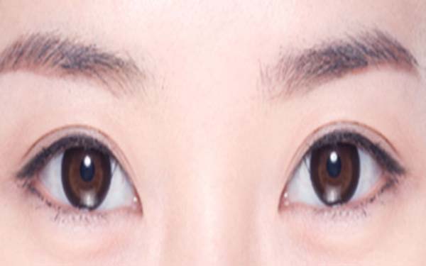 割完<a href=http://www.sbs17.com/listinfo-724-0.html target=_blank class=infotextkey>雙眼皮</a>多久可以懷孕